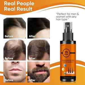 Hair and Beard Growth Spray 200 ml Pack of 2